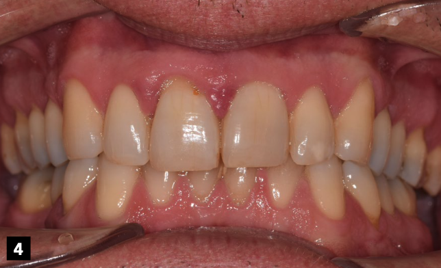 Image for Wat als ik niets doe?