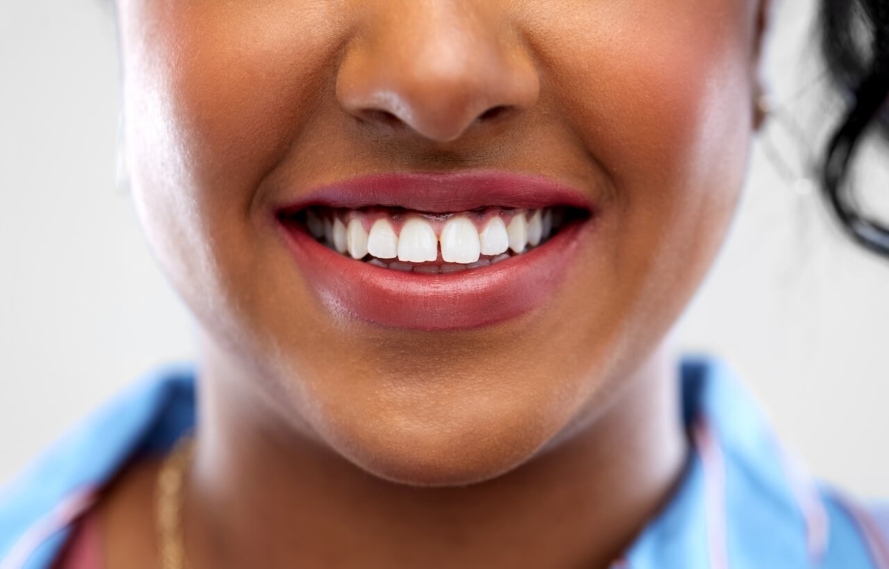 Tips voor wittere tanden